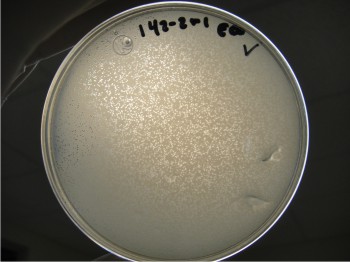 Figura 1. Placas de lisis de bacteriófagos.