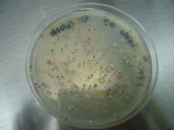 Figura 2. Aislados obtenidos de la rizósfera de papa infectada con Streptomyces.